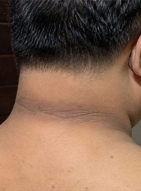 Dark Neck Causes Explained: Why It Happens and What It Could Mean