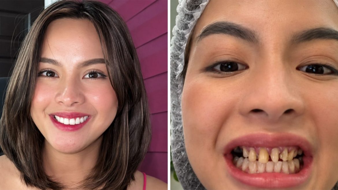 Split image of Erica Pineda showing her smiling portrait beside a close-up view of her natural teeth before veneers.