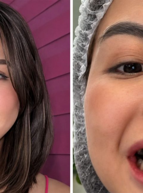 Erica Pineda Veneer Reveal Sparks Debate on Beauty Standards