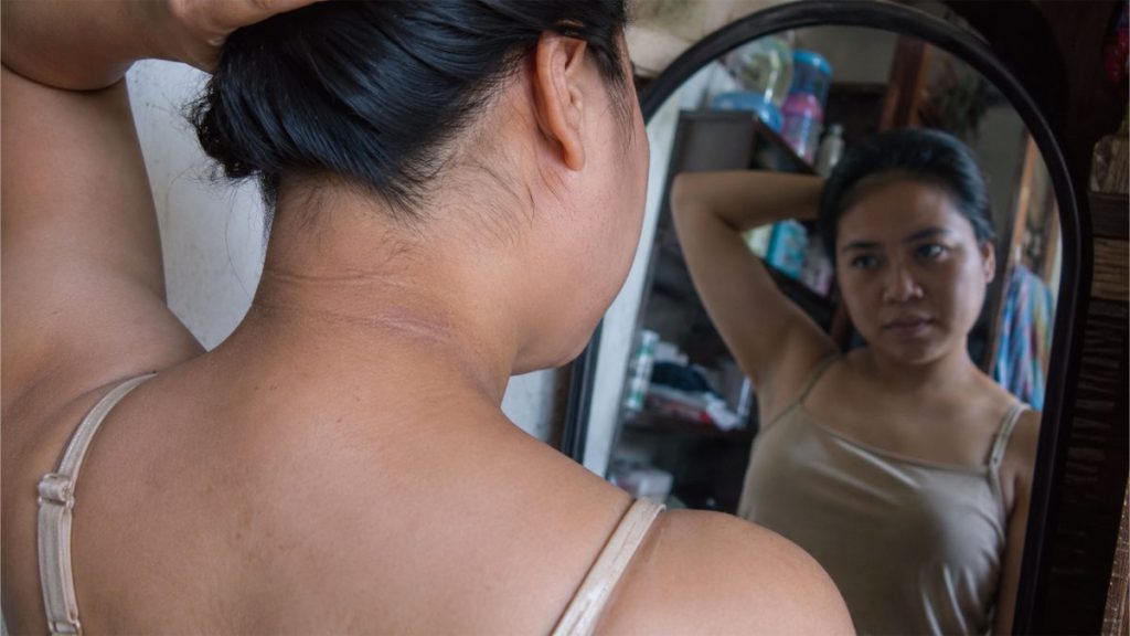 Filipina woman looking at dark neck skin in mirror at home